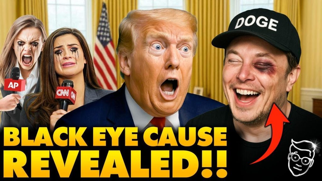 Elon’s Mysterious BLACK EYE in Oval Office Stuns Media, Musk’s Response to Reporter Makes Room ROAR
